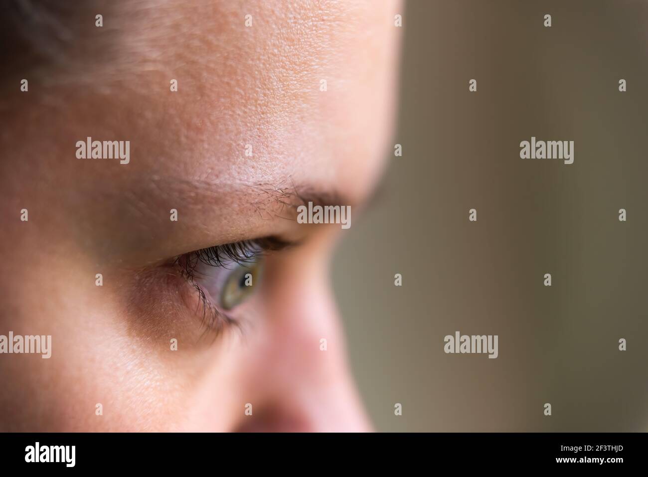 Macro gros plan de la jeune femme visage portrait dans le côté profil Avec la maladie de grave hyperthyroïdie symptômes de l'ophtalmopathie gonflement des yeux proptose edem Banque D'Images