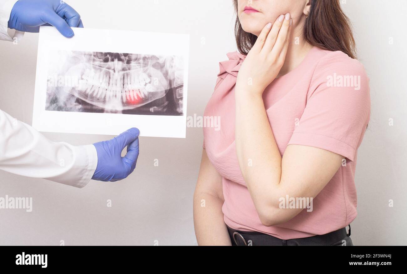 Le chirurgien dentiste montre la dent de sagesse du patient sur les rayons X. Concept de chirurgie dentaire, douleur quand la dentition sagesse dent, médicinal Banque D'Images