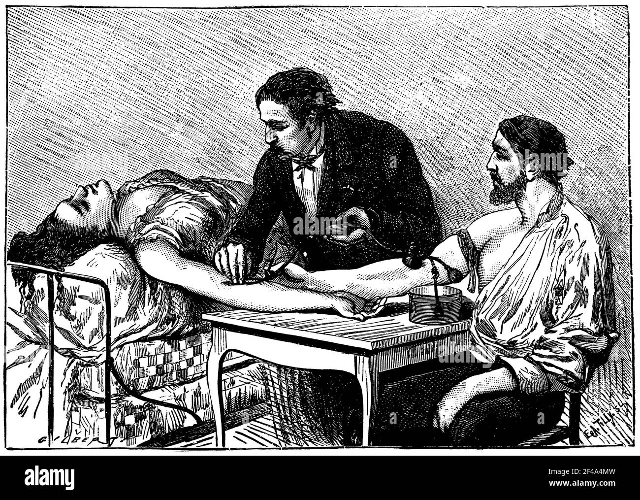 Drainage de sang ou transfusion. Illustration du 19e siècle. Allemagne. Arrière-plan blanc. Banque D'Images