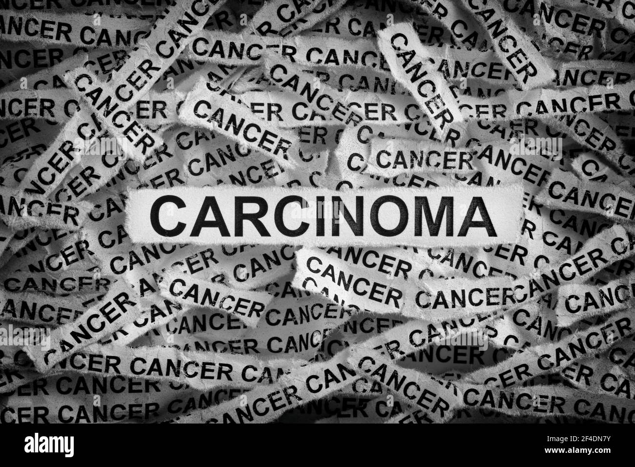 Carcinome. Morceaux de papier déchirés avec les mots carcinome et cancer. Noir et blanc. Gros plan. Banque D'Images