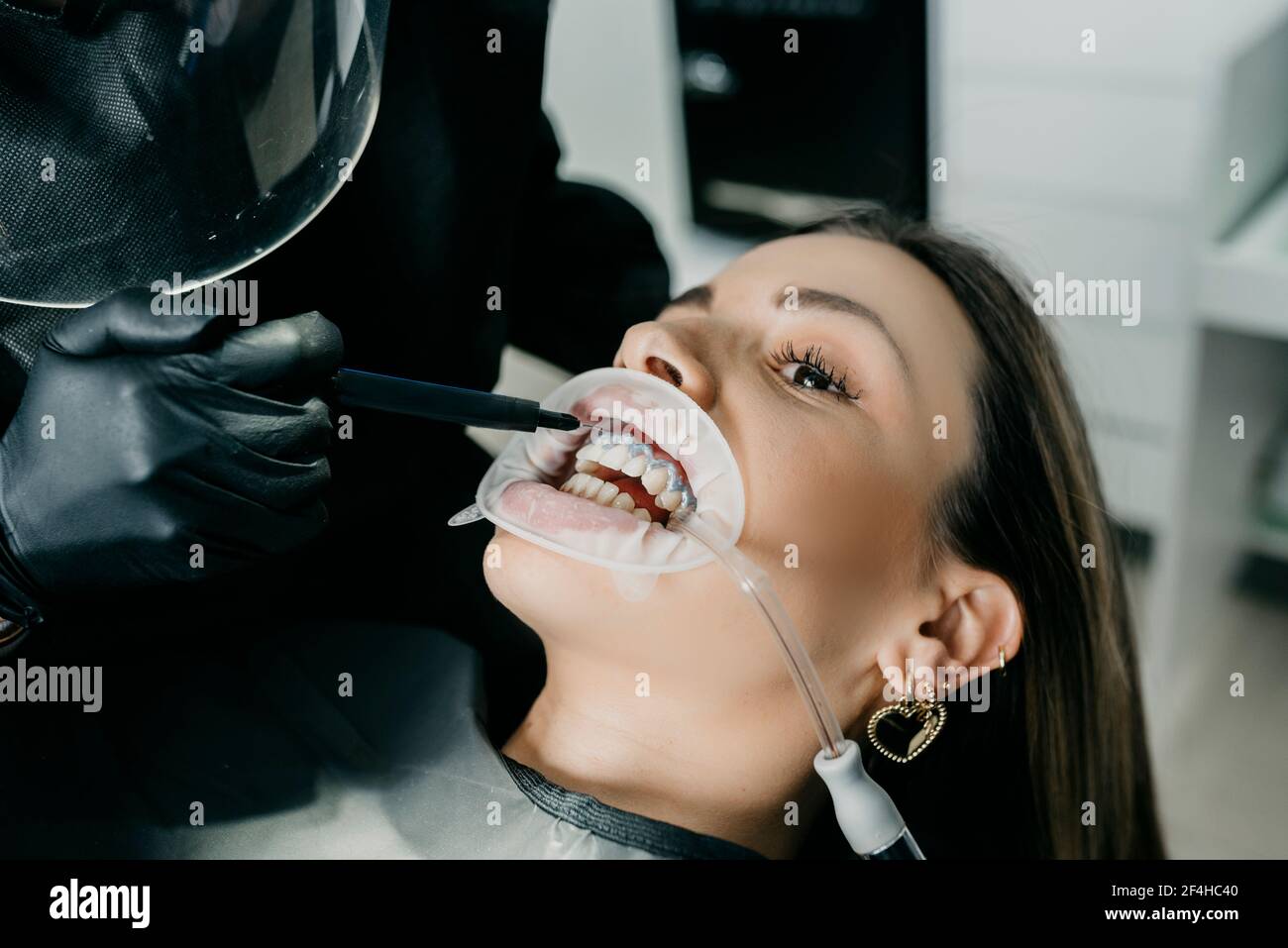 Rognez la pâte photosensible du dentiste non reconnaissable tout en traitant les dents de femelle avec éjecteur de salive et enrouleur dans la bouche Banque D'Images Rognez la pâte photosensible du dentiste non reconnaissable tout en traitant les dents de femelle avec éjecteur de salive et enrouleur dans la bouche Banque D'Images