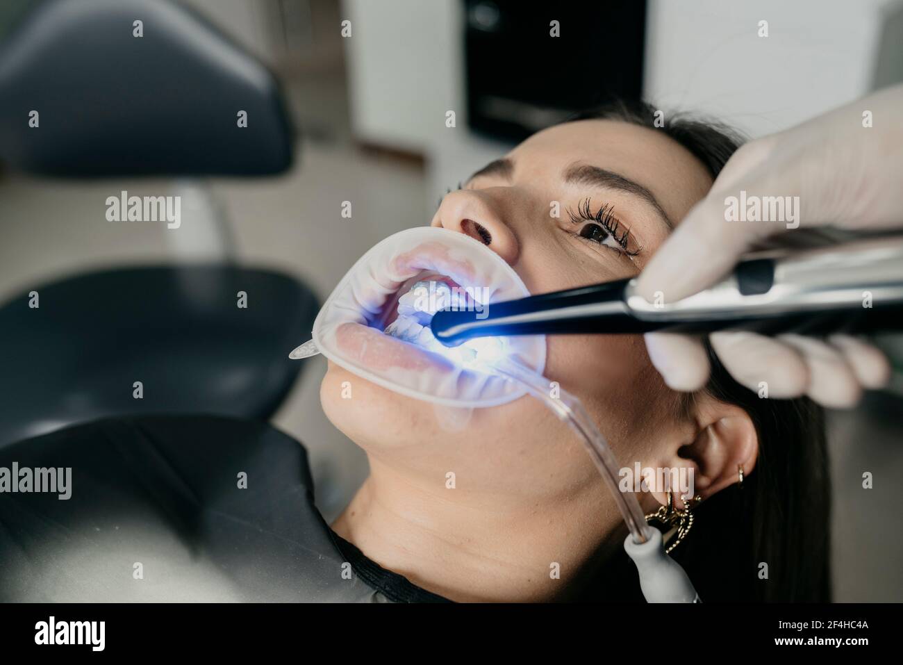 Croquez un dentiste méconnaissable à l'aide d'une lumière de durcissement dentaire pendant le traitement des dents de la femelle avec éjecteur de salive et enrouleur dans la bouche Banque D'Images Croquez un dentiste méconnaissable à l'aide d'une lumière de durcissement dentaire pendant le traitement des dents de la femelle avec éjecteur de salive et enrouleur dans la bouche Banque D'Images