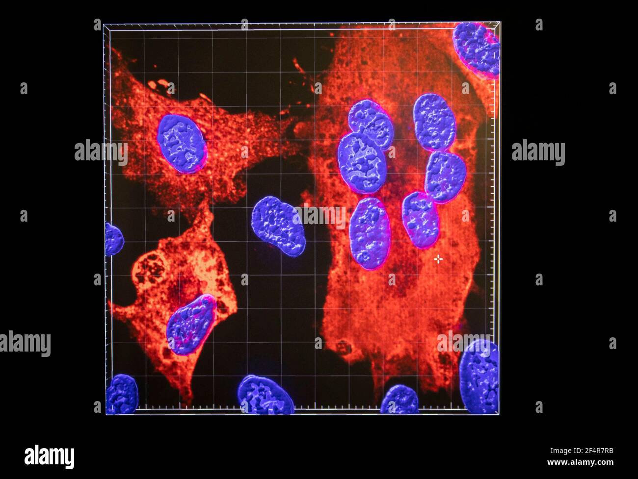 Une image créée au microscope confocal montre que les noyaux cellulaires (bleus) sont infectés par le SRAS-COV-2 (zones rouges), le virus qui cause le COVID-19, dans les laboratoires de biosécurité Richard Elliott (REBL), installations de niveau de confinement 3, au Centre de recherche sur les virus MRC-Université de Glasgow. Date de la photo: Mardi 16 mars 2021. Banque D'Images