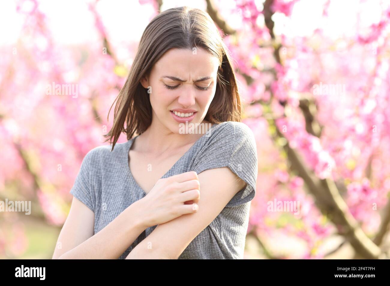 Femme stressée se grattant le bras qui démange après une piqûre d'insecte dans un champ d'arbres de pêche au printemps Banque D'Images