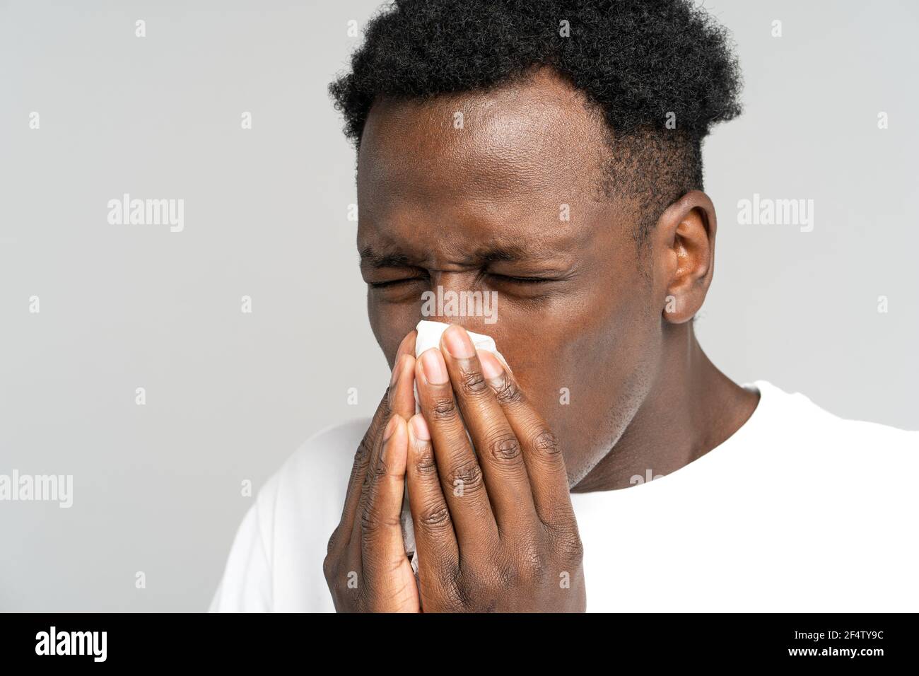 Le mâle noir éternuant dans la serviette, souffrant d'allergie saisonnière, la rhinite, a des symptômes de rhume Banque D'Images