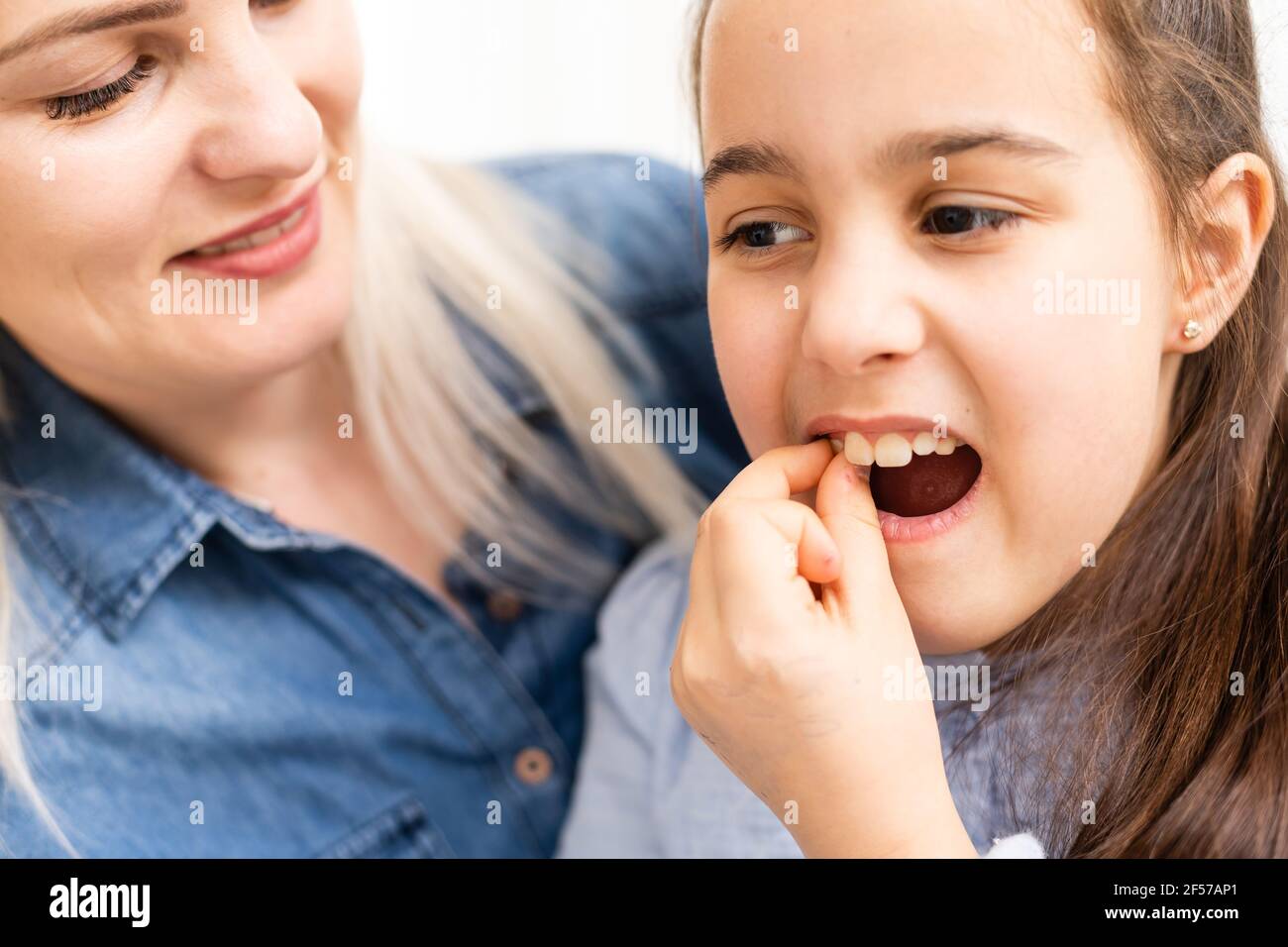 Une Dent De Bebe Lache Tombe Dans Une Petite Fille Avec Une Bouche Ouverte Photo Stock Alamy