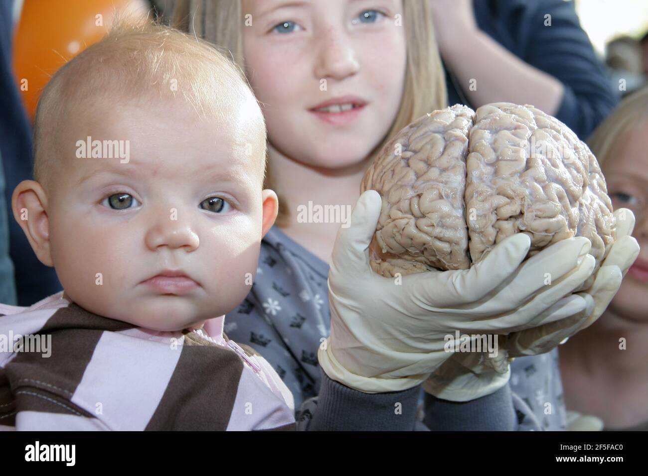 Lobe Temporal Banque D Image Et Photos Alamy
