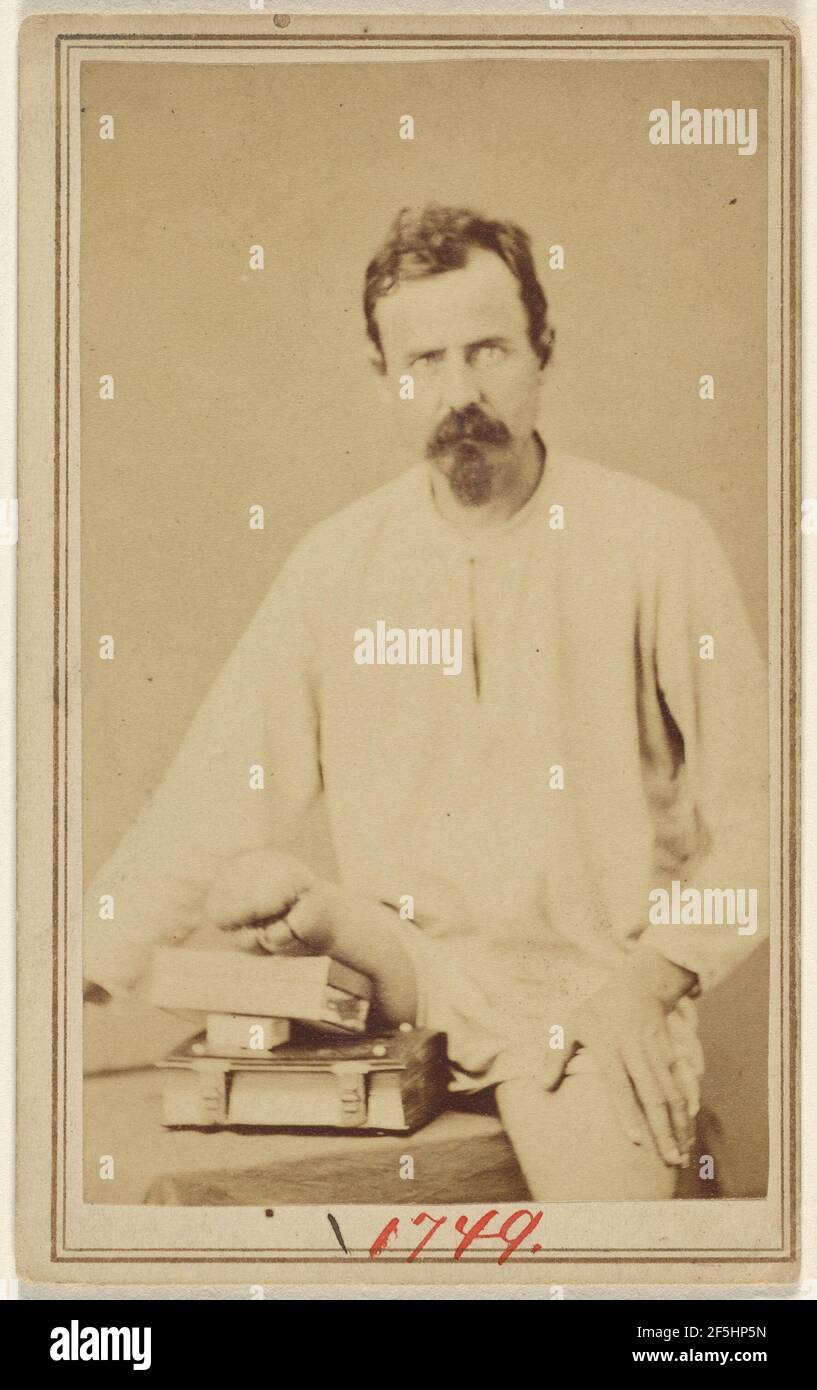 Victime non identifiée de la guerre de Sécession avec sa jambe multilatée soutenue. Attribué à William H. Bell (américain, 1830 - 1910) Banque D'Images