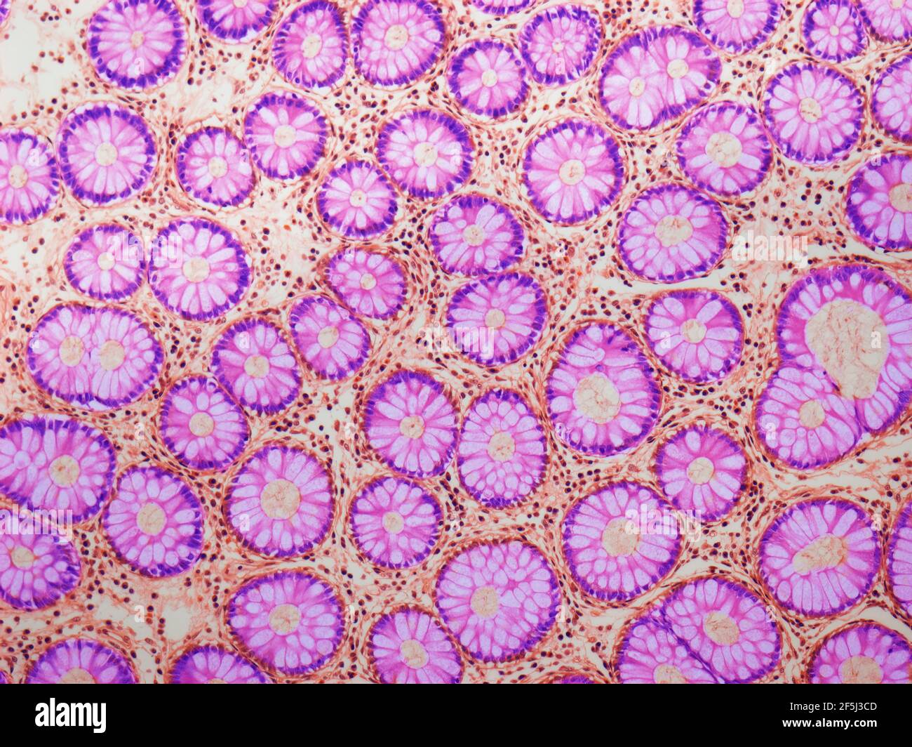 Cryptes de Lieberkuhn, LM Banque D'Images