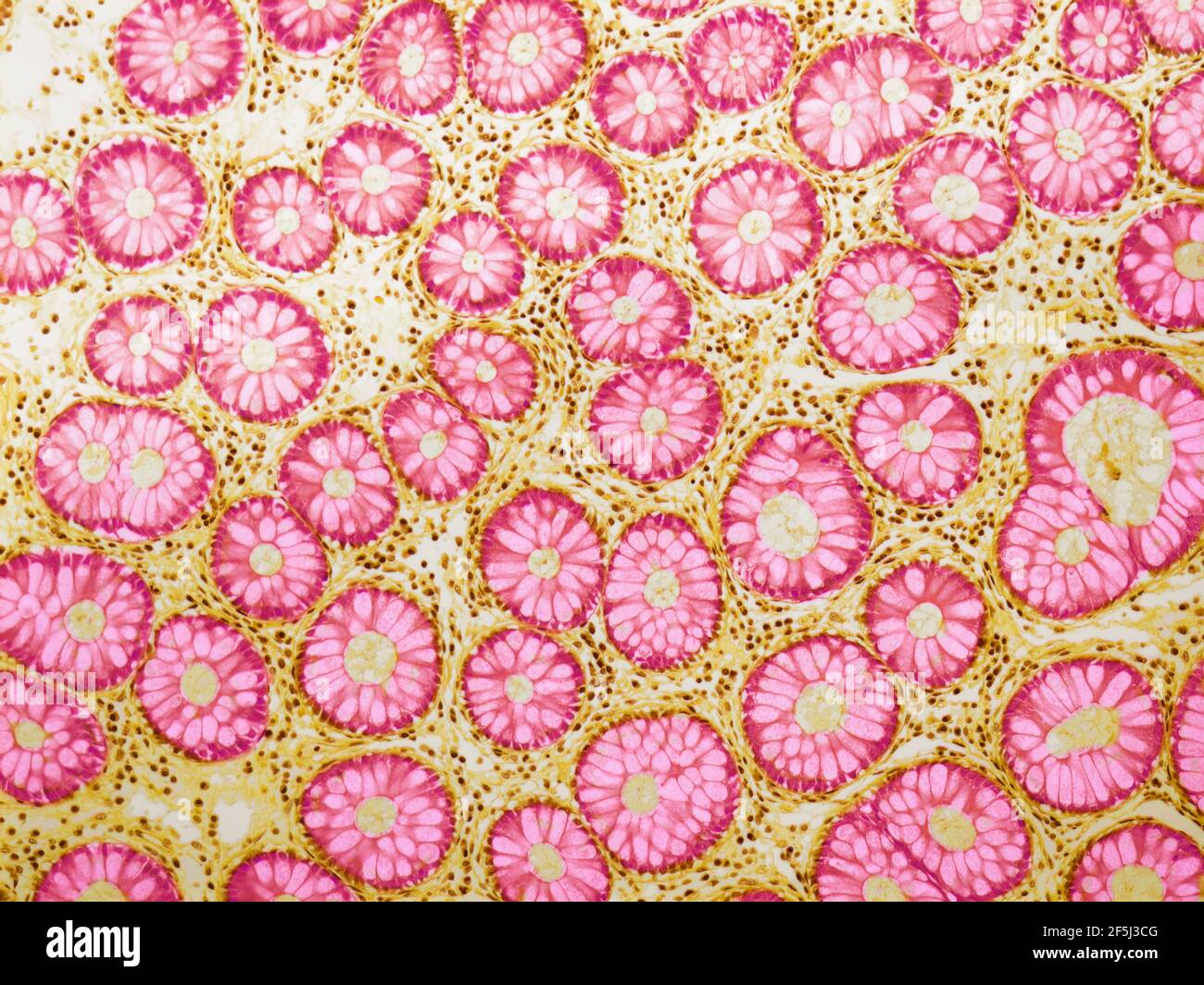 Cryptes de Lieberkuhn, LM Banque D'Images