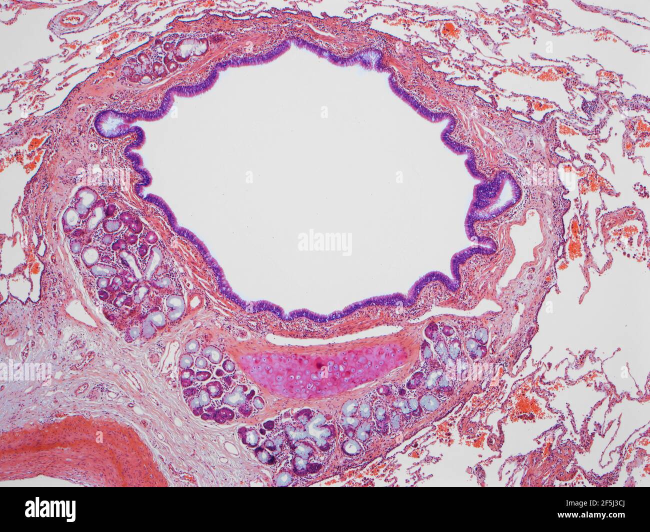 Bronchiole pulmonaire, LM Banque D'Images