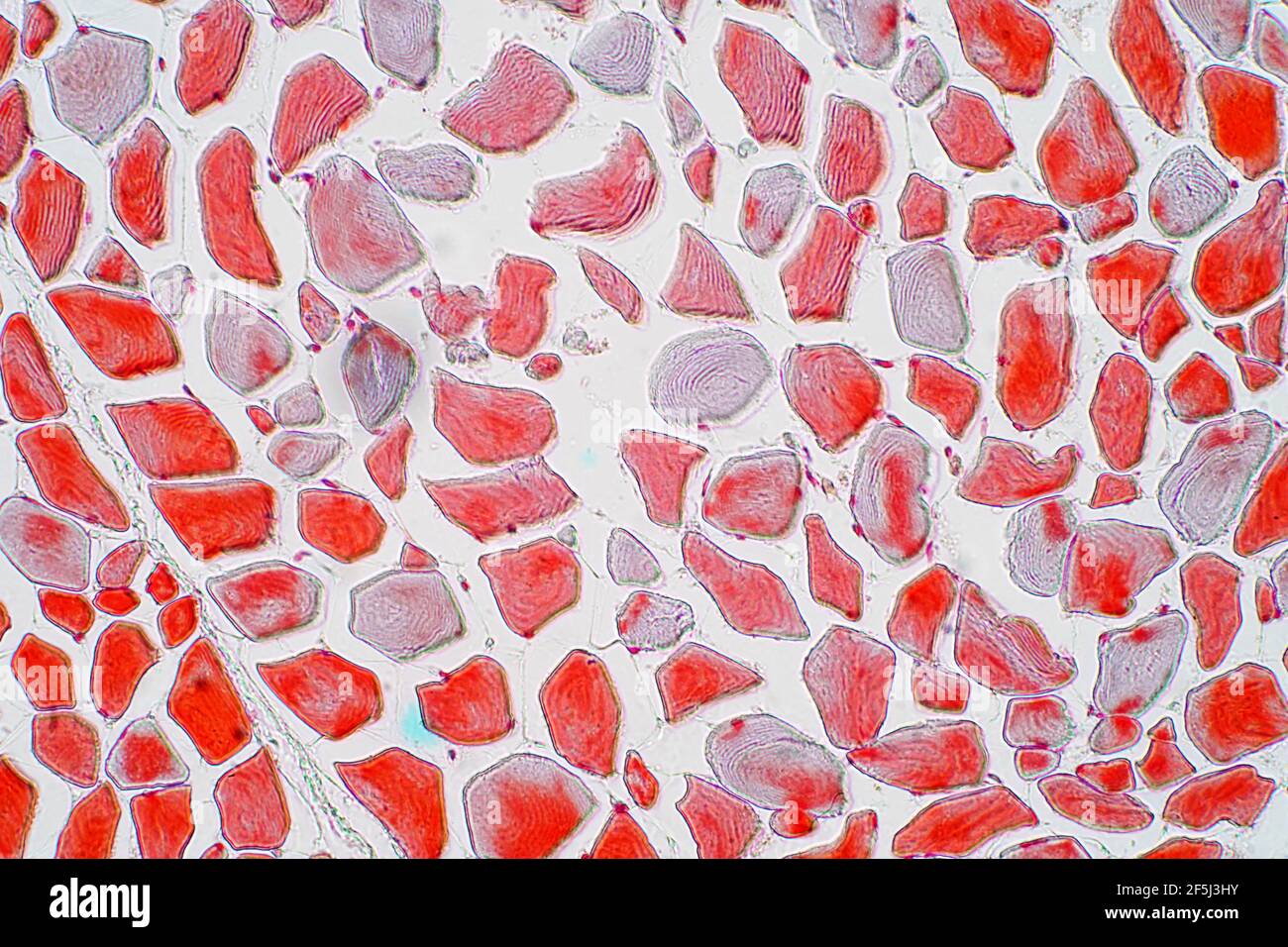 Muscle squelettique, micrographe léger Banque D'Images