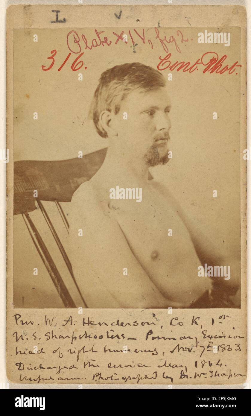 PRIV. W.A. Henderson, vicitie de la guerre de Sécession. W. Thompson (américain, actif dans les années 1860) Banque D'Images