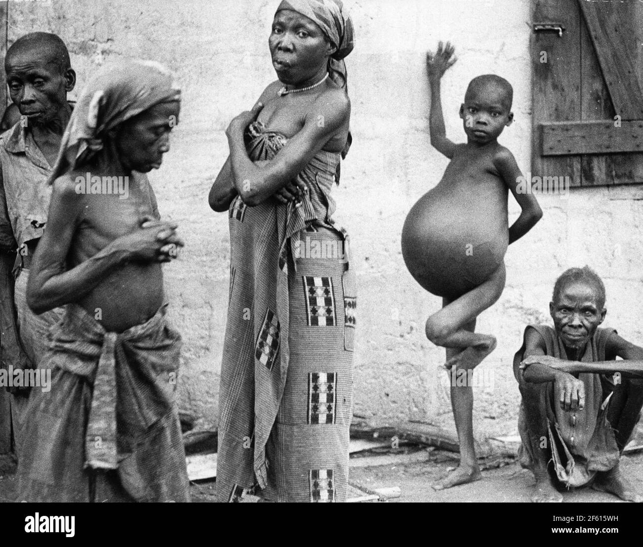 Biafra 1968-12-25 la guerre civile nigériane (également connue sous le nom de guerre du Biafran et guerre du Nigeria-Biafran). Famine dans la région de Biafra pendant la guerre. Photo: Sven-Erik Sjoberg / DN / TT / code 53 Banque D'Images