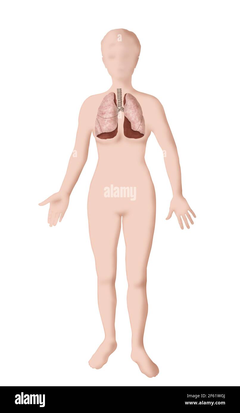 Illustration pulmonaire Banque D'Images