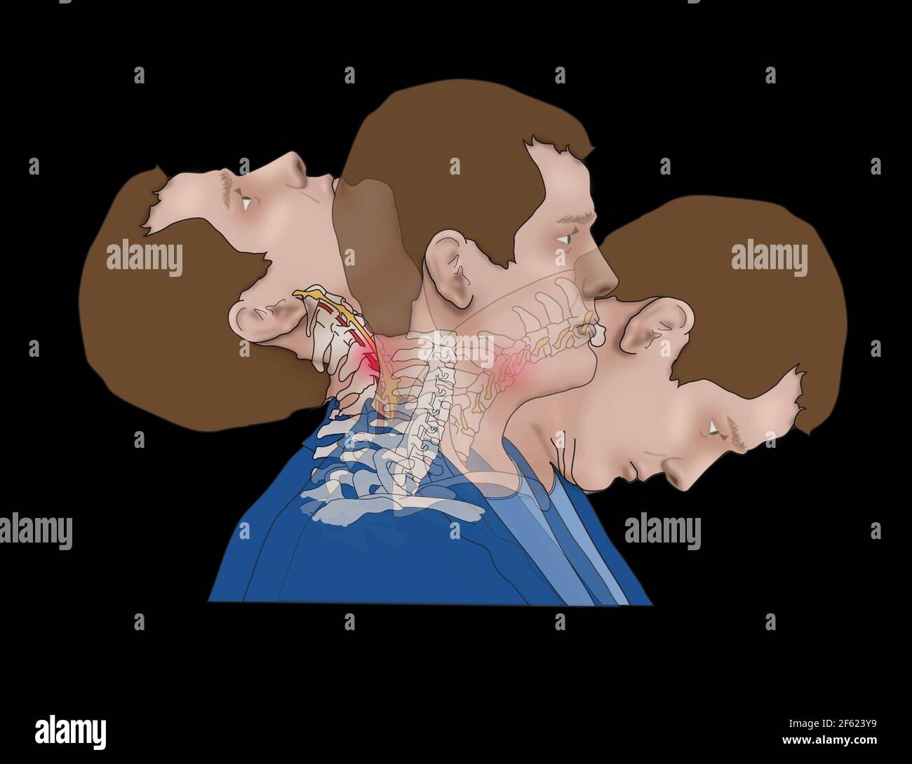 Coup de fouet, illustration Banque D'Images