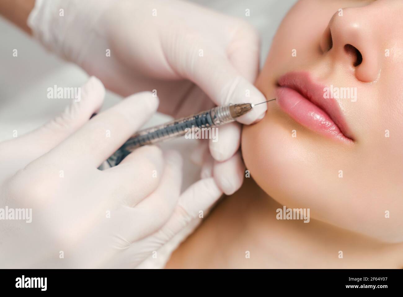 Procédure d'augmentation et de correction des lèvres dans un salon de cosmétologie. Le spécialiste effectue une injection dans les lèvres du patient. Banque D'Images