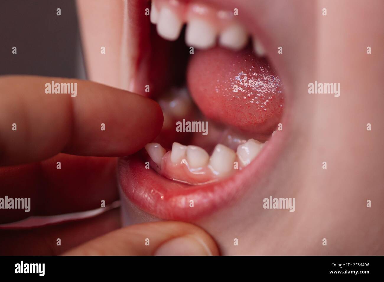 Le Gros Doigt De La Mere Tire La Dent De Bebe Lache Du Bas De Bebe Machoire Photo Stock Alamy