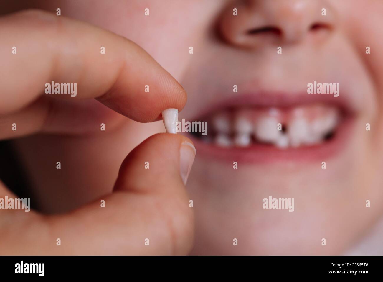 Gros Plan Du Pouce Et De L Index Tenir La Dent De Bebe Tombee Ou Retiree L Incisive Avant Avec La Bouche Sans Dents Floue De L Enfant En Arriere Plan Photo Stock Alamy