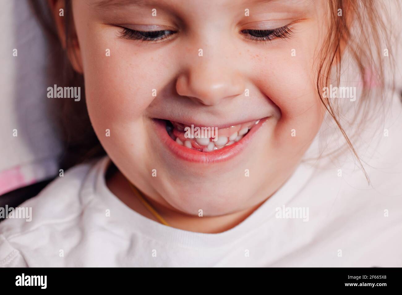 gros plan sur le visage espiègle et joyeux d'une fille avec un trou dans la rangée inférieure des dents de la première dent de bébé qui vient de tomber Banque D'Images