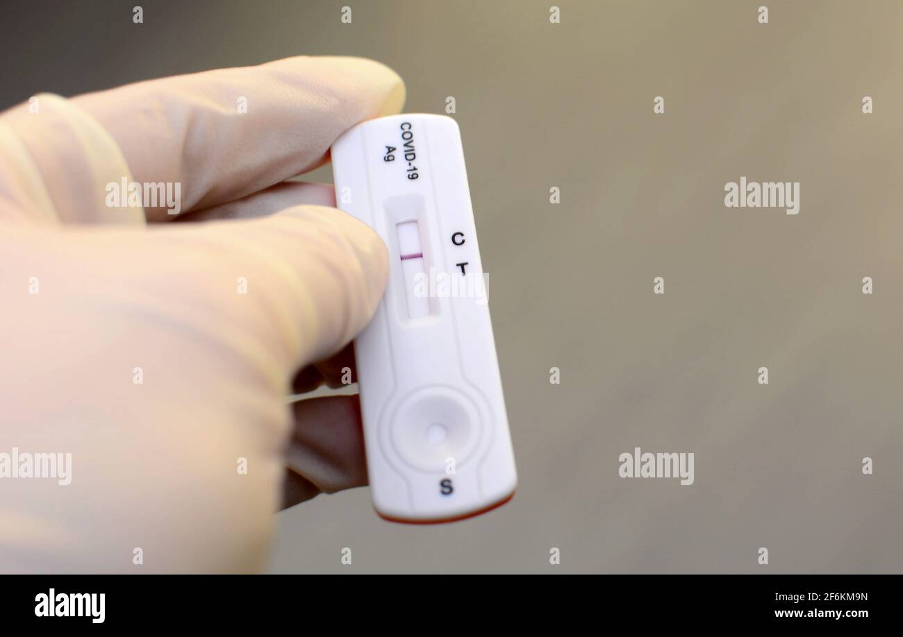 La main dans des gants médicaux est tenue d'un test rapide d'antigène négatif pour la capture des anticorps COVID-19. Il affiche un résultat négatif. Banque D'Images La main dans des gants médicaux est tenue d'un test rapide d'antigène négatif pour la capture des anticorps COVID-19. Il affiche un résultat négatif. Banque D'Images