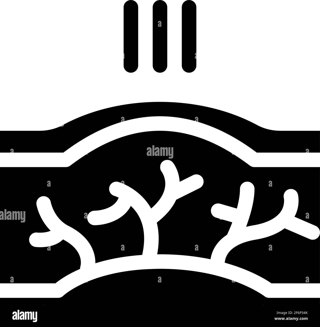 illustration du vecteur de la maladie des varices Illustration de Vecteur