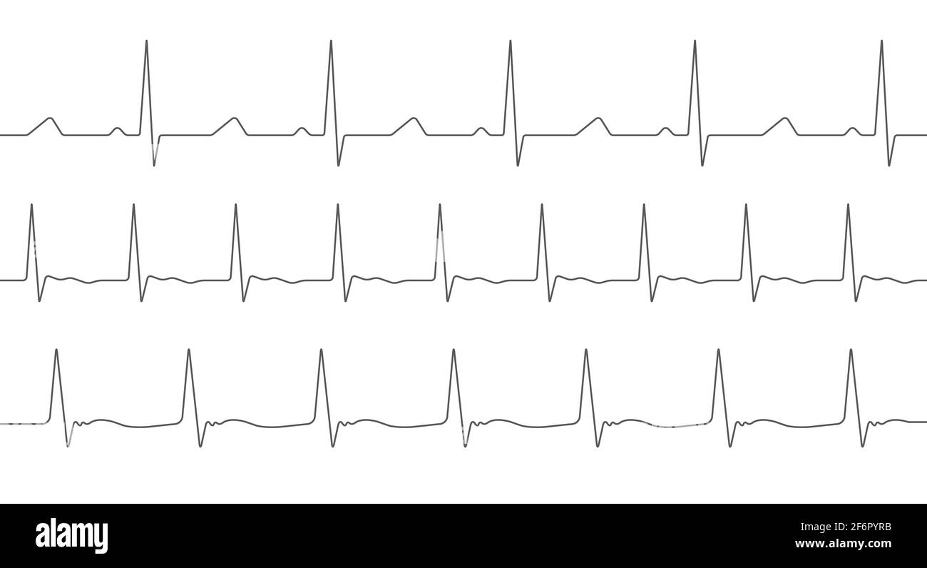 Jeu de cardiogrammes. Trois différents. Ligne de pulsation. Collection de différentes ondes de battements cardiaques. Illustration isolée sur blanc. Banque D'Images