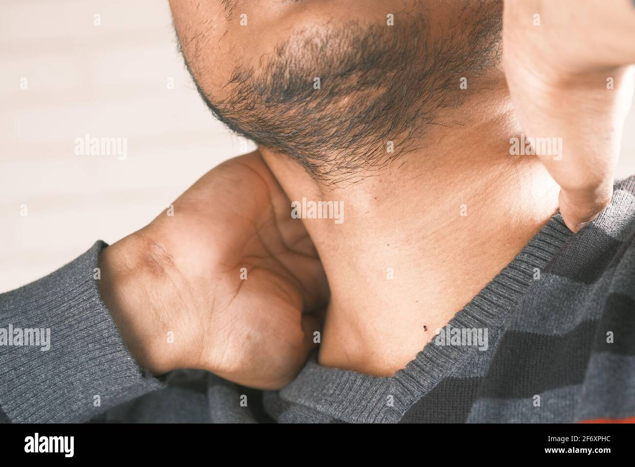 homme souffrant de douleurs chroniques au cou Banque D'Images