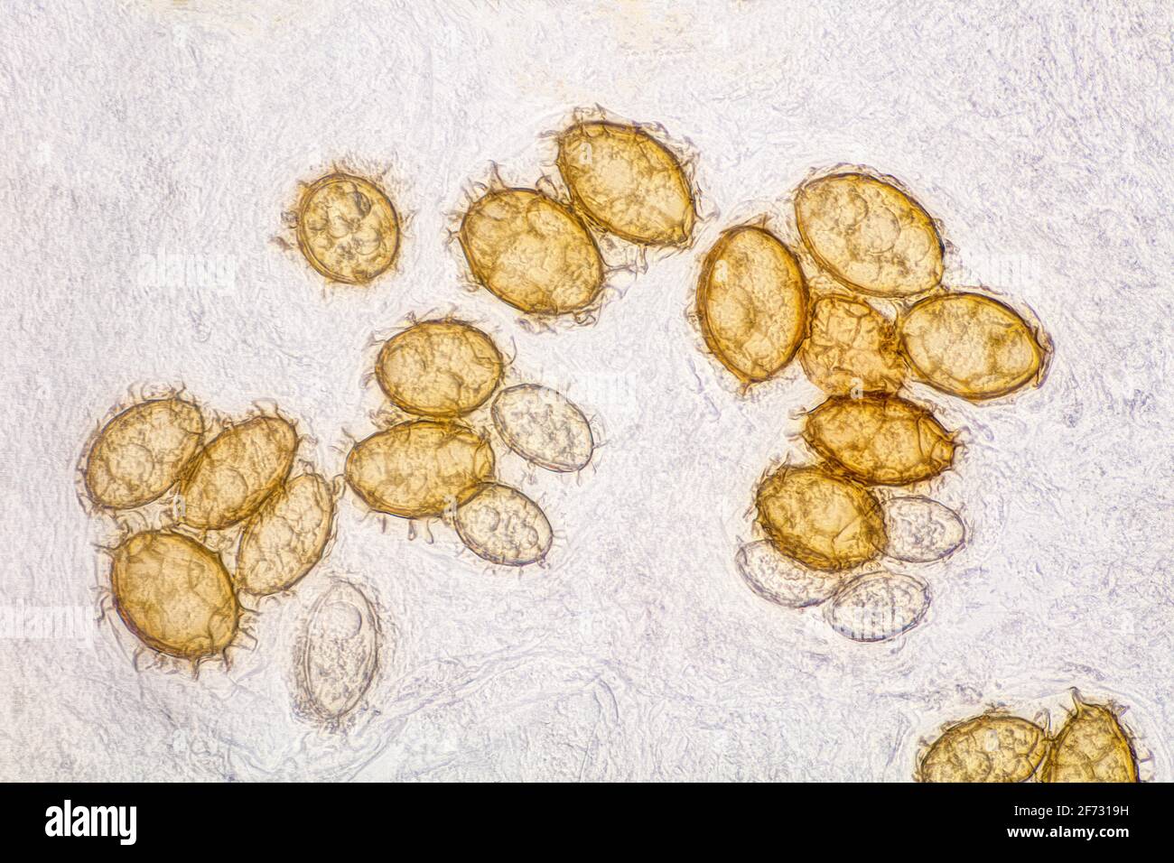 Truffe de Bourgogne (Tuber uncinatum), spores de truffe d'automne Banque D'Images