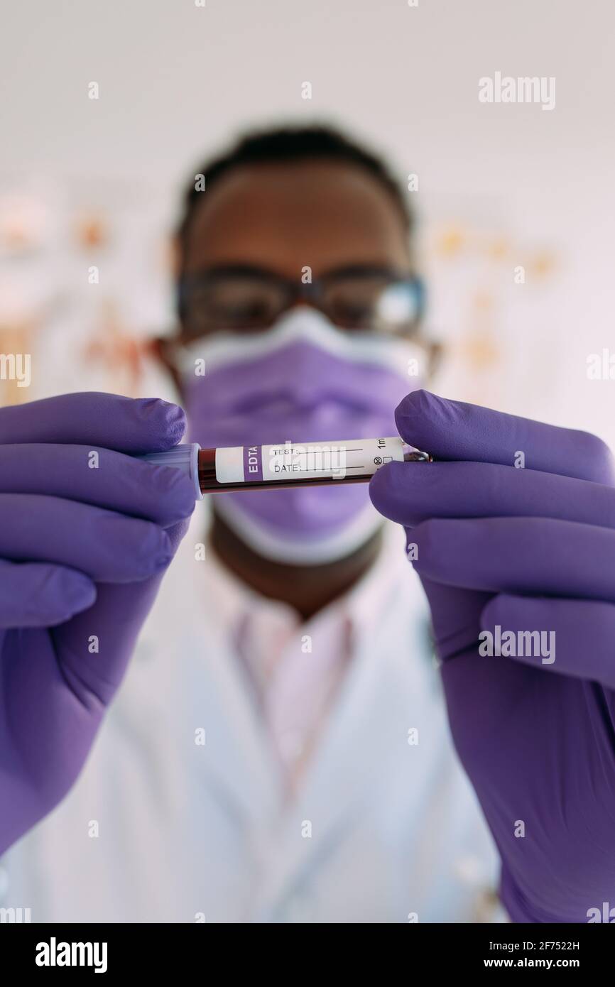 Afro-américain médecin en gant médical démontrant tube à essai avec échantillon de sang sur fond blanc Banque D'Images