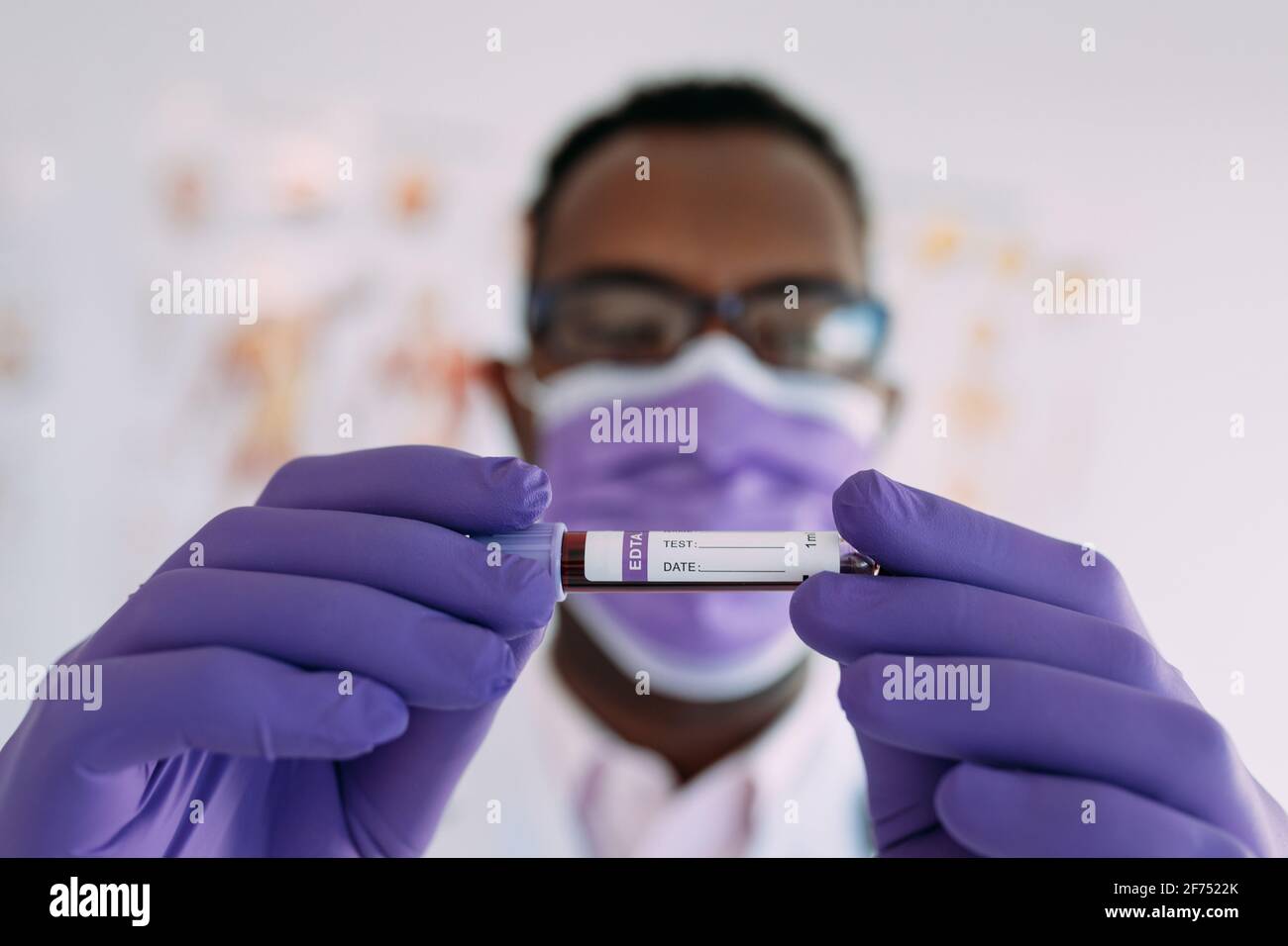 Afro-américain médecin en gant médical démontrant tube à essai avec échantillon de sang sur fond blanc Banque D'Images