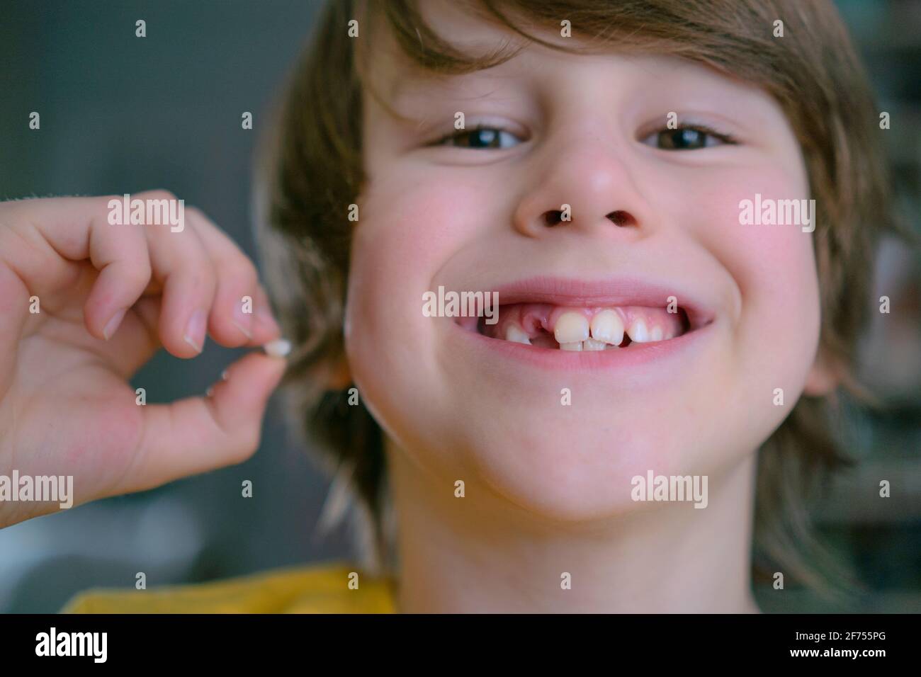 La dent de lait du garçon est tombée. Un enfant satisfait tient une dent dans sa main. Un trou dans la gomme est visible Banque D'Images