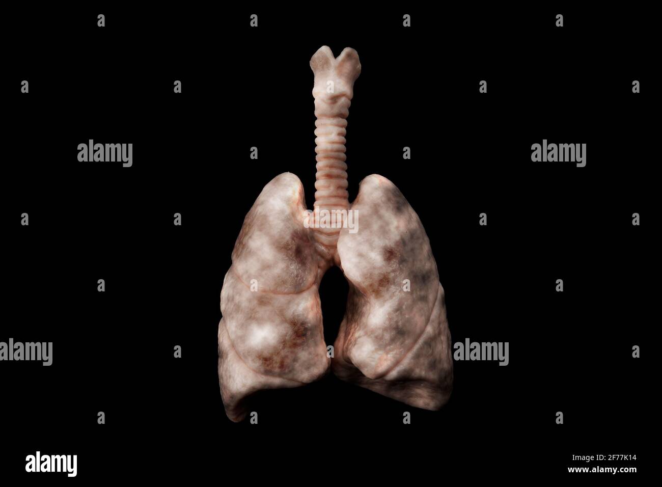 Les cigarettes nuisent à votre santé, le cancer du poumon, l'interdiction de fumer et la dépendance à la nicotine thème de concept avec des poumons malades inhalant la fumée cancéreuse sur le dos noir Banque D'Images