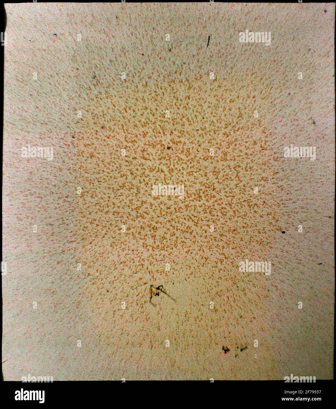 AGFA autochrome. Photographies médicales.A-cellules sanguines 112 jour. WR dans le sérum propre. Grain fin. Formation du rouleau de patin. OBJ. A ². Banque D'Images