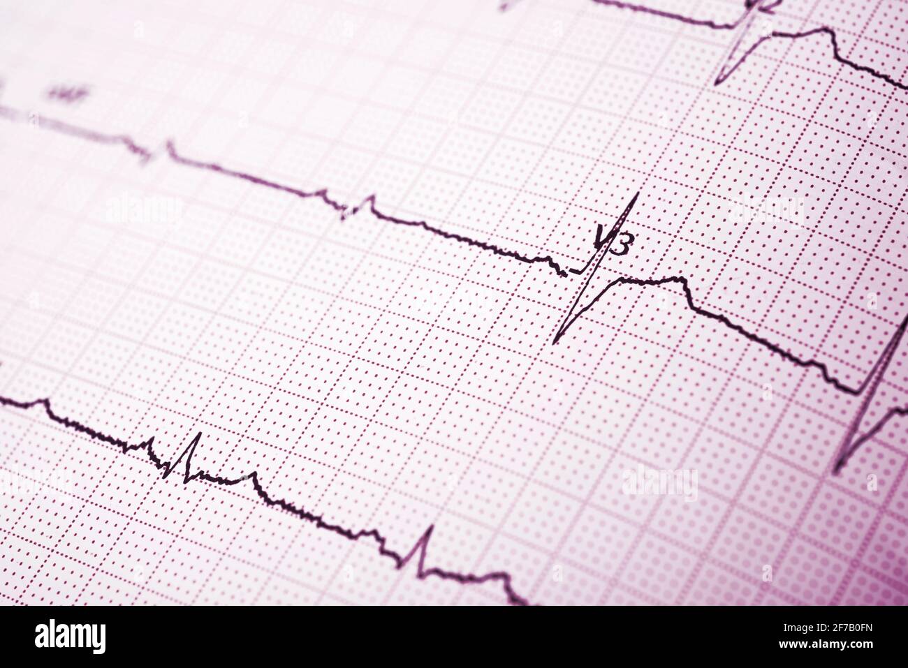 Close up d'un électrocardiogramme sous forme papier. Banque D'Images