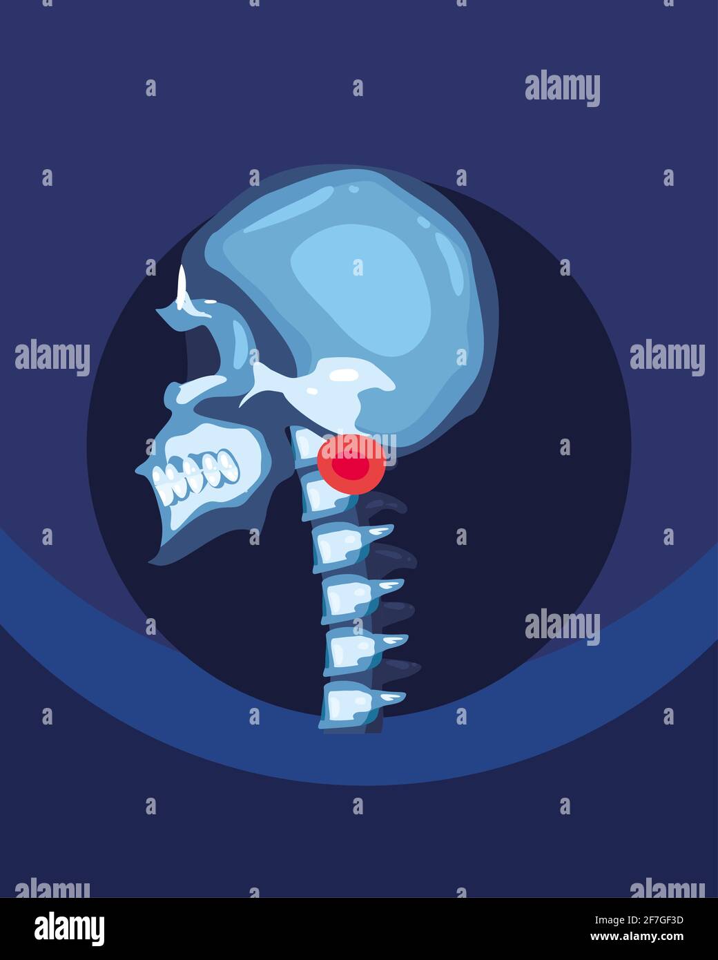 crâne de rhumatologie avec os de la colonne vertébrale Illustration de Vecteur