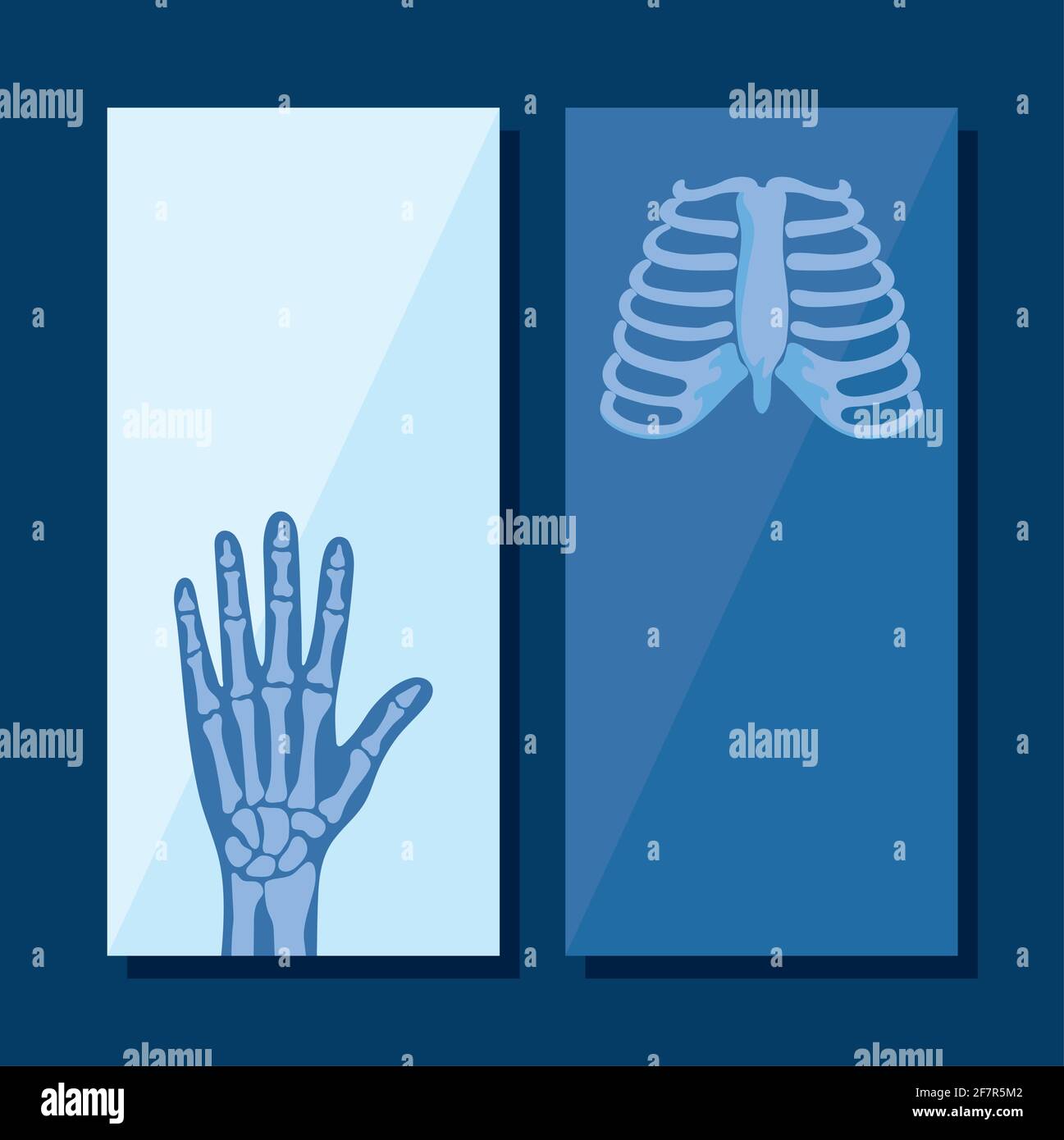 ensemble d'affiches de rhumatologie Illustration de Vecteur