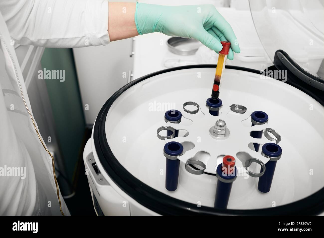 Préparation de plasma sanguin dans une centrifugeuse pour la plasmoliftation et procédures cosmétiques pour le rajeunissement de la peau Banque D'Images
