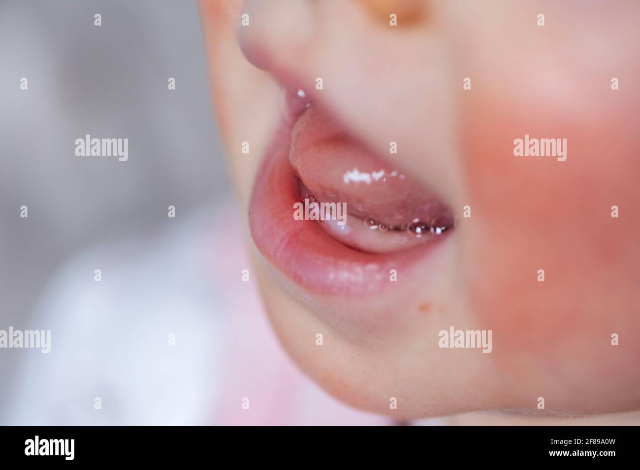 Gums And Lips Banque D Image Et Photos Alamy
