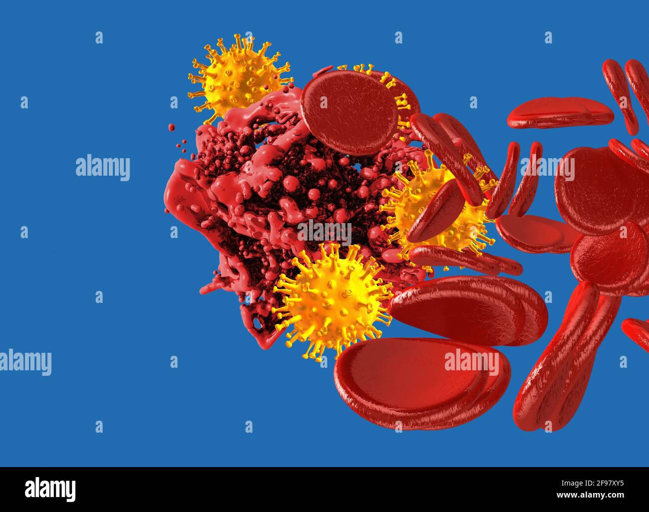 Coagulation sanguine et coronavirus, illustration conceptuelle Banque D'Images