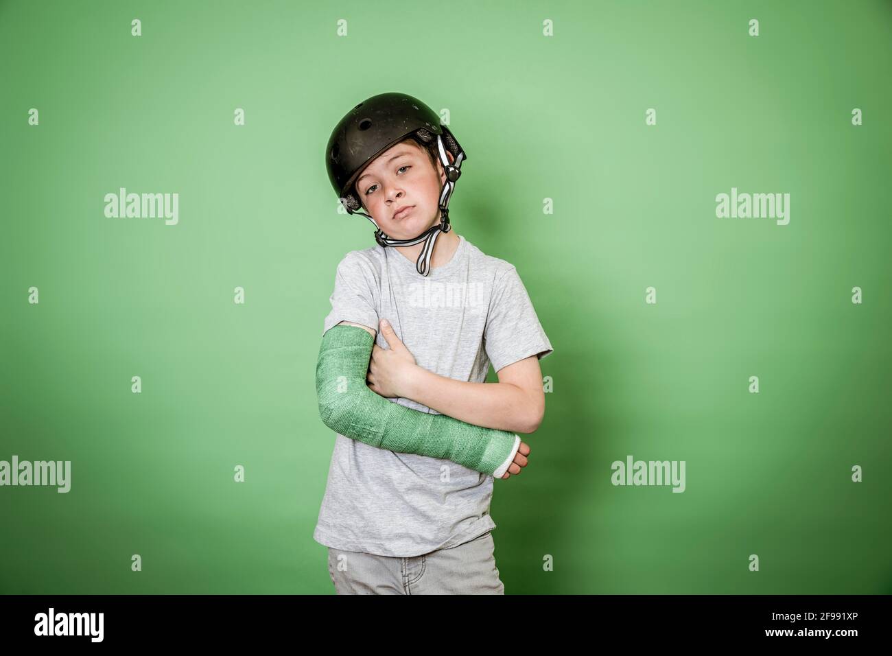 cool brave boy avec le bras cassé et le plâtre vert pour les mains pose  avec un casque de skater devant un fond vert le studio Photo Stock - Alamy