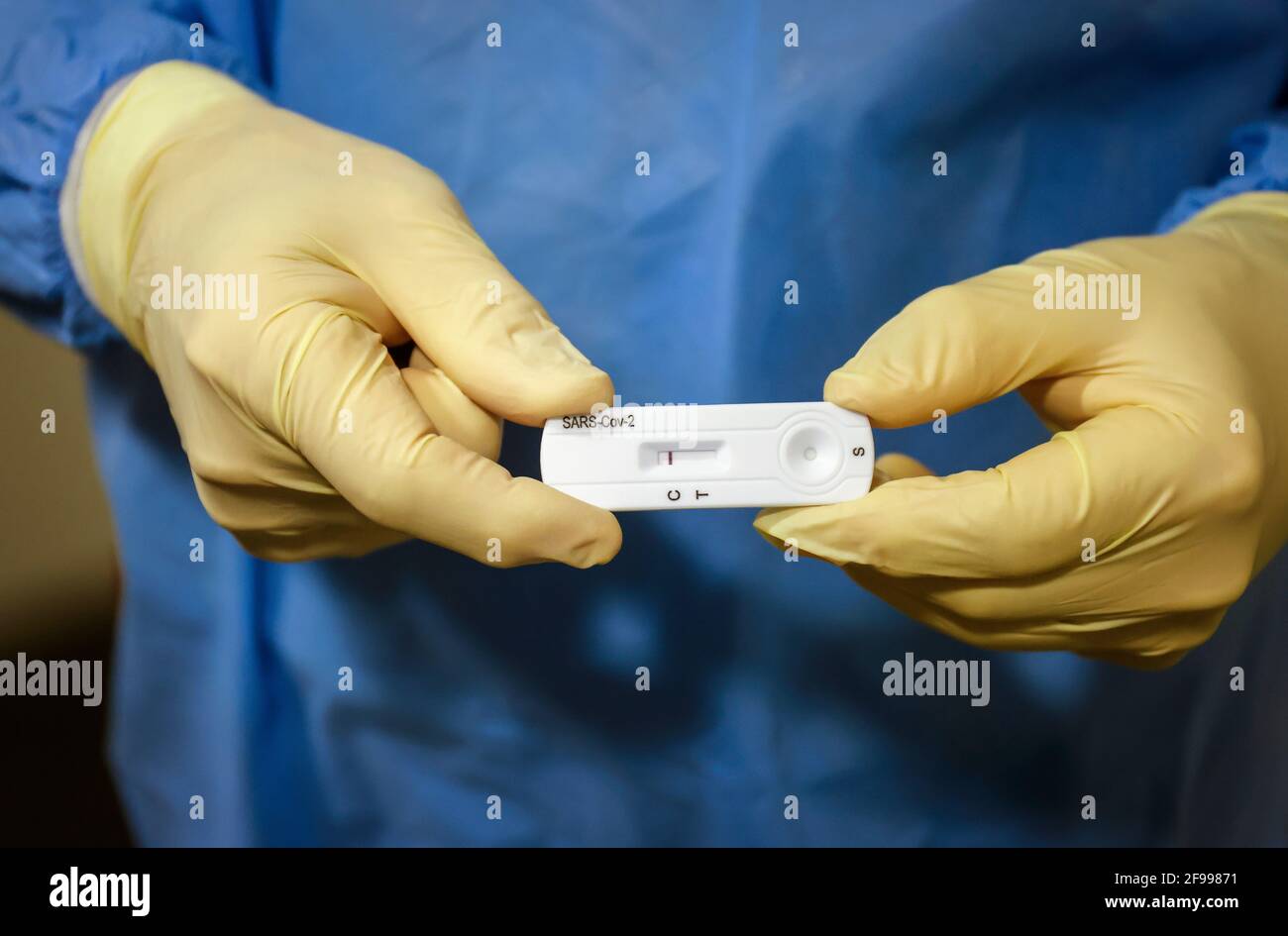 Essen, Rhénanie-du-Nord-Westphalie, Allemagne - Corona centre de test Grugahalle ouvert pour le test citoyen gratuit, Covid rapide test, un médecin montre un test Corona rapide négatif, à partir du 8 mars, les citoyens allemands peuvent être testés pour Corona une fois par semaine gratuitement dans le centre de test rapide. Banque D'Images