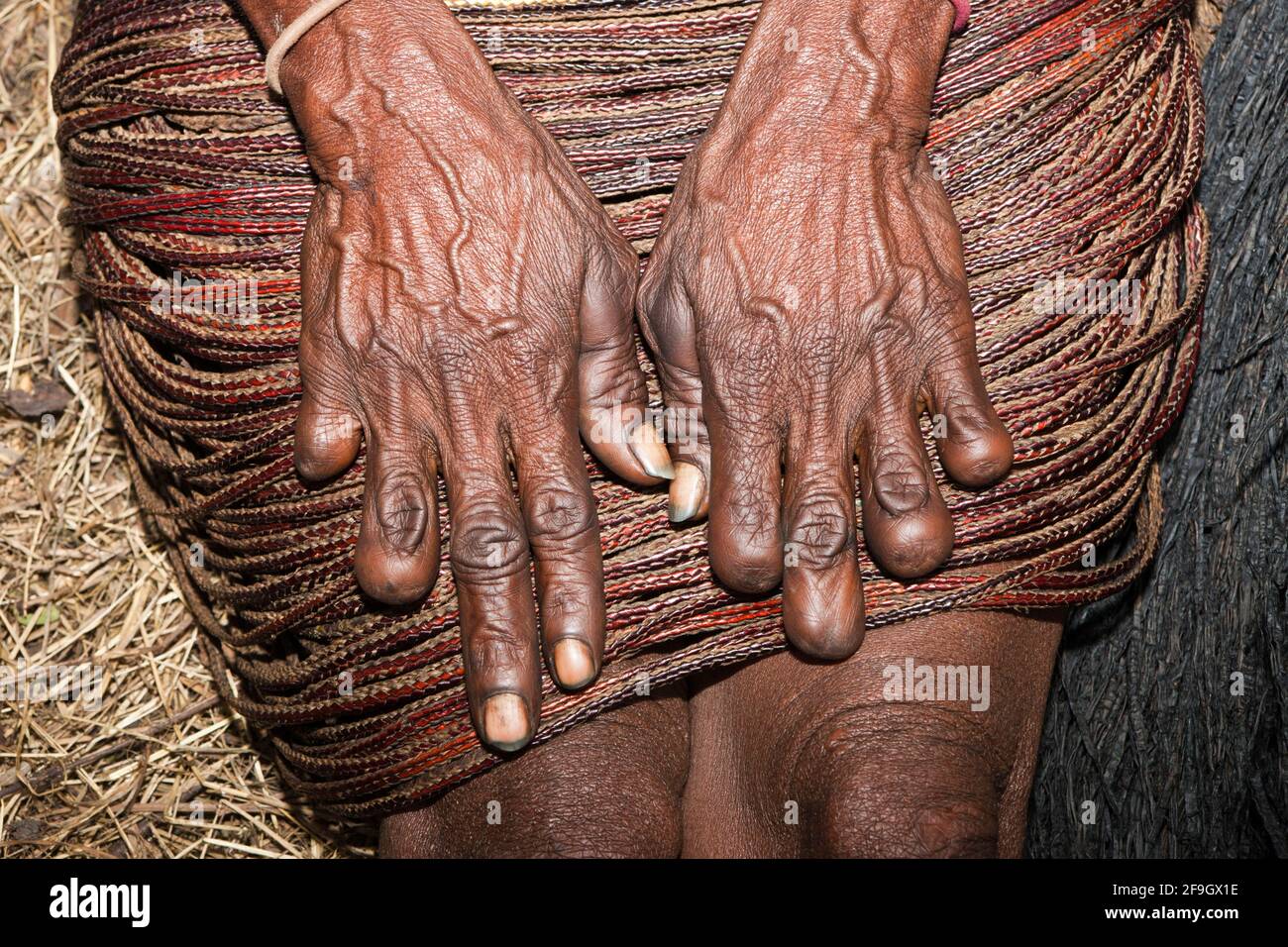 Mains de Dani femme, doigt amputé, tradition sur la mort d'un proche parent, Baliem Valley, Papouasie occidentale, Indonésie Banque D'Images