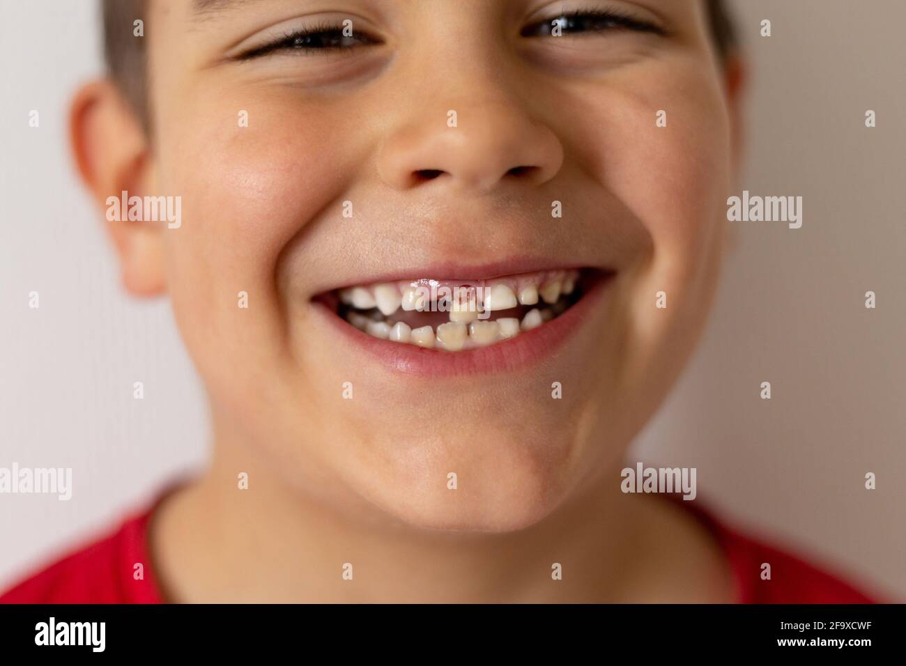 Dents de lait avec racine Banque de photographies et d’images à haute — free download
