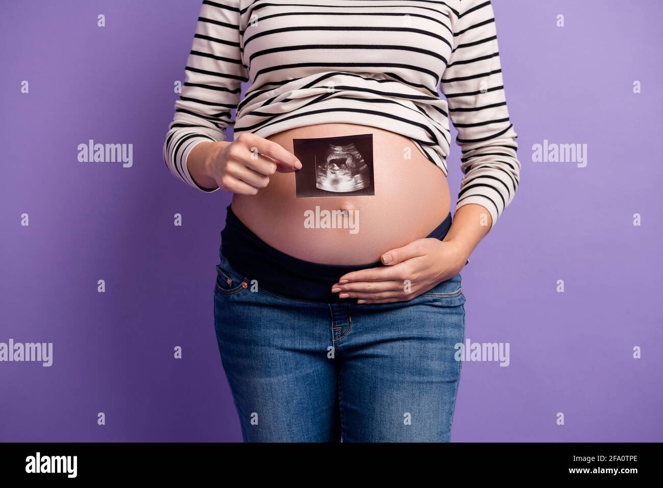 Photo rognée de la femme enceinte montrant l'icône de rayons X main abdomen  porter une chemise rayée isolée couleur violet arrière-plan Photo Stock -  Alamy