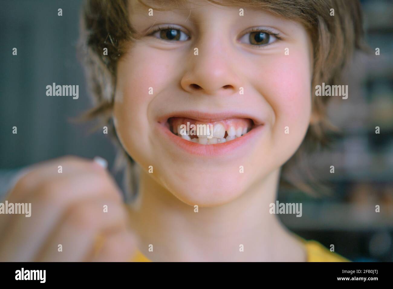 La dent de lait du garçon est tombée. Un enfant satisfait tient une dent dans sa main. Un trou dans la gomme est visible Banque D'Images