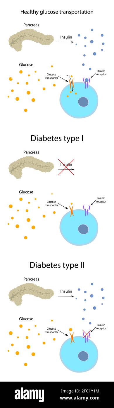 Diabète et métabolisme sain du glucose, illustration Banque D'Images