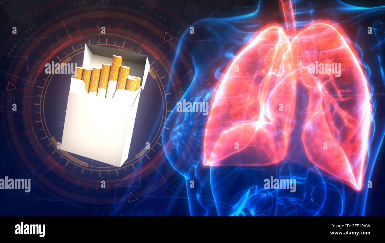 cg médecine 3d illustration, les problèmes des poumons humains par les cigarettes Banque D'Images