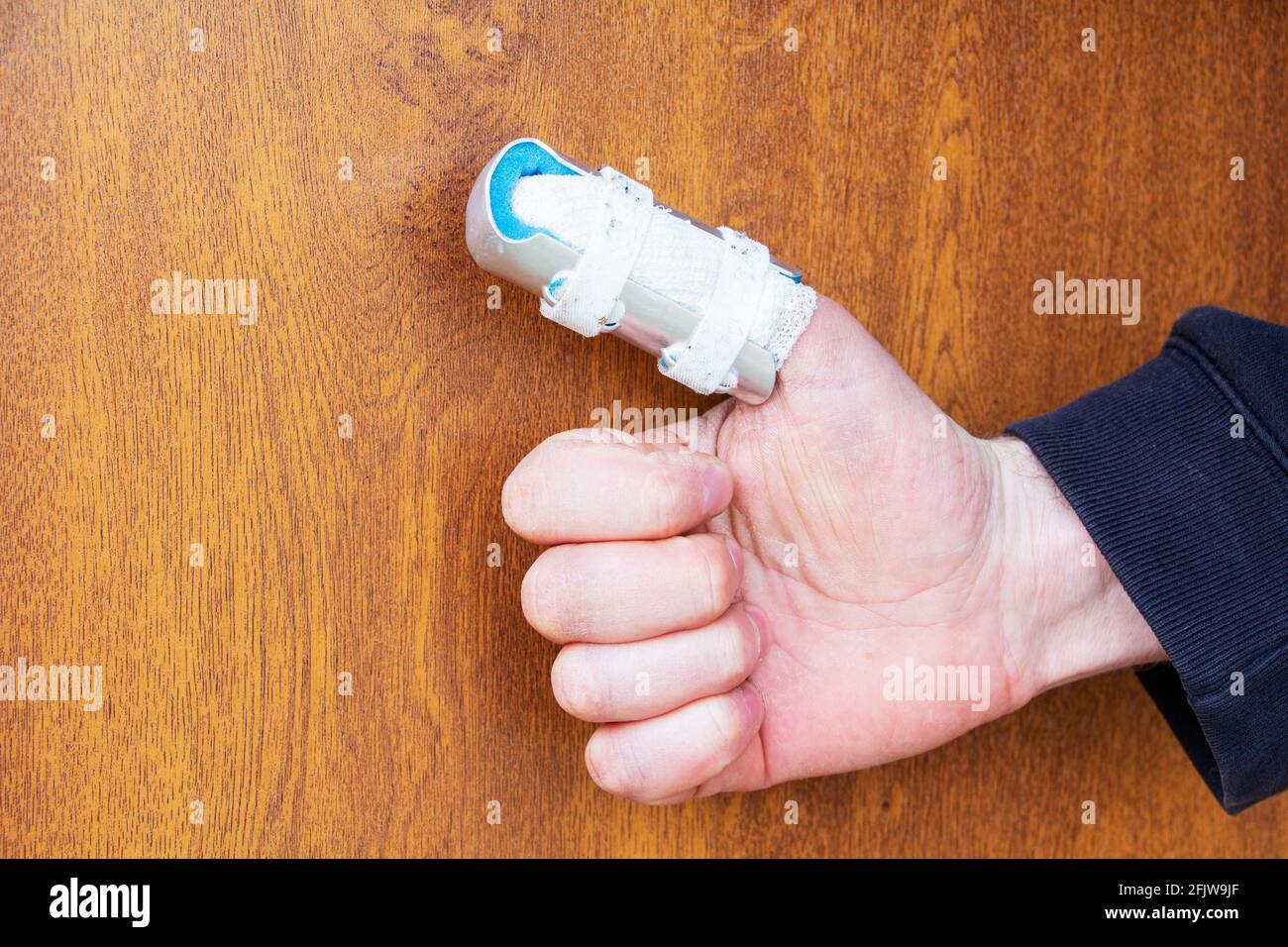 Cast broken hand thumb Banque de photographies et d'images à haute  résolution - Alamy