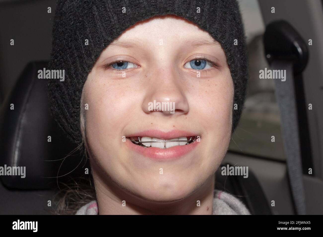Gros plan d'une adolescente dans un chapeau noir avec des bretelles en fer sur ses dents, souriant, assis dans un salon de voiture. Lisser la morsure et la beauté des dents. Banque D'Images